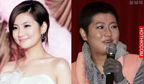 Selina燒傷前後照片對比，事發後她與「張承中」都是分房睡...沒想到阿中最後竟然... ...
