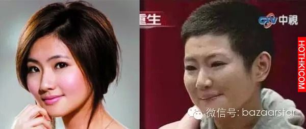Selina和阿中離婚了，全身54%燒傷的Selina，因用藥三年都不能懷孕，任爸原本要阿中「 ...