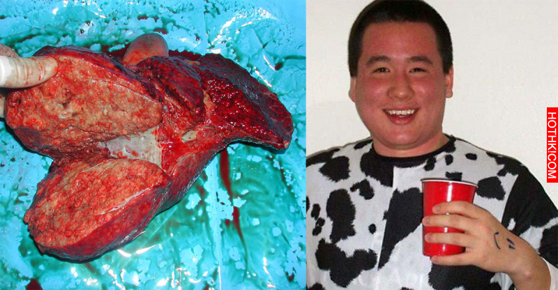 震驚! 身邊這「兩種人」最容易得到肝癌，醫生強調千萬要戒酒啊! ...