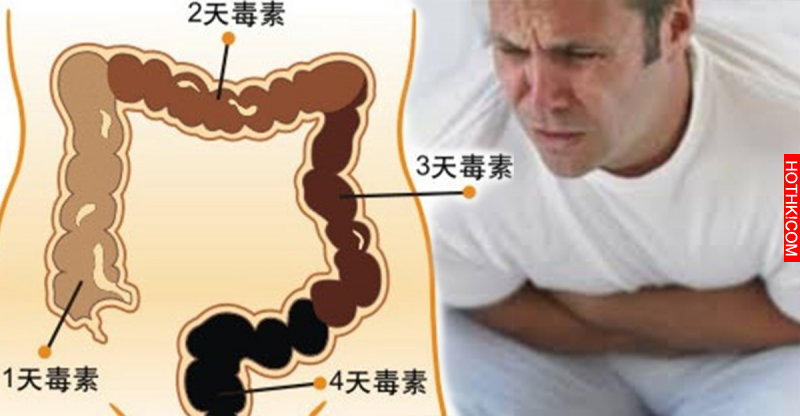 我便秘了三十年，沒想到試了隔壁阿姨告訴我的秘方，我的宿便終於像米袋破洞一樣狂噴不 ...