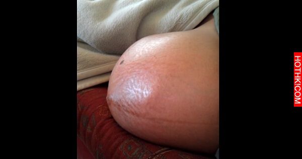 懷上雙胞胎的孕婦對著肚皮開始錄影，下一秒拍到的東西太驚悚了．．．她的肚子裡竟然是 ...