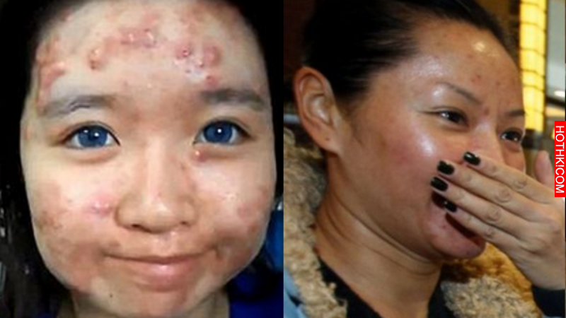 注意！女生們千萬不可以有「這些習慣」！否則皮膚崩壞的速度會比地球暖化還可怕！尤其 ...